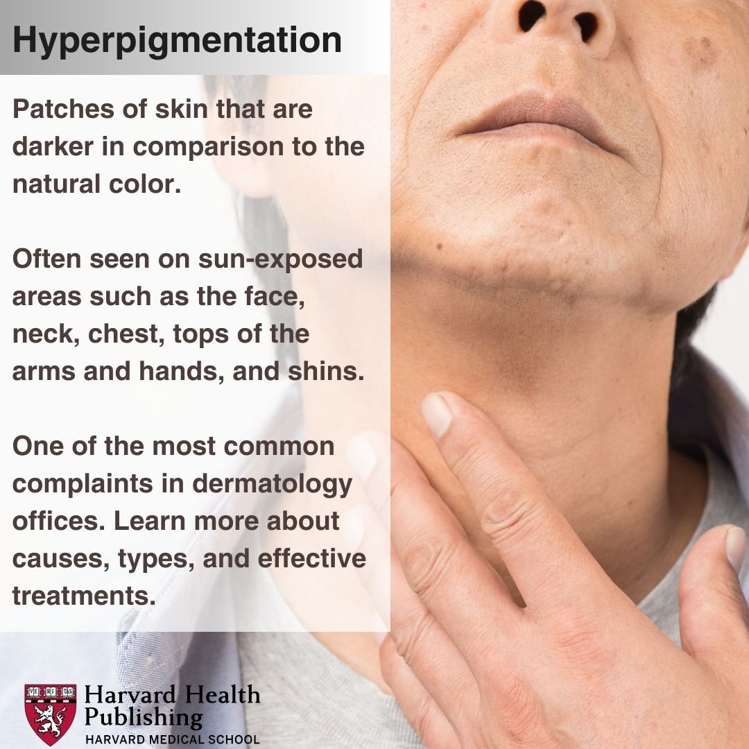 A man touches his neck with his hand. His throat and lower face can be seen.