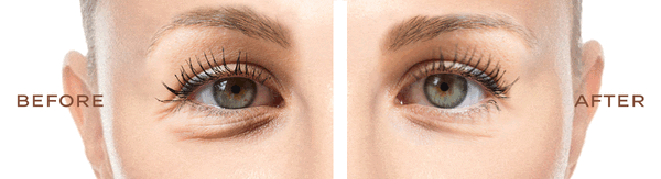 Supreme Recontour Eye Concentrate Transformation Results