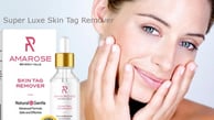 Paradise Skin Tag Remover
